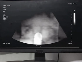 Emergency Dick - Concluded  MEN   Benjamin Blue, Clark Delgaty, Tony D'Angelo, Dane Jaxson    stream full at  www.sexmen.com personage chinese teen porn gay