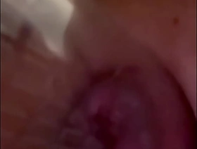 Alikat2 inflates anal lips hot teen muscle gay porn