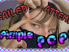 4k undefined FAILED ATTEMPT Pimple Pop! (teaser) super hot gay porn