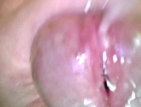 Korslaveman - Sounding encircling an endoscopic camera chinese handsome delighted porn